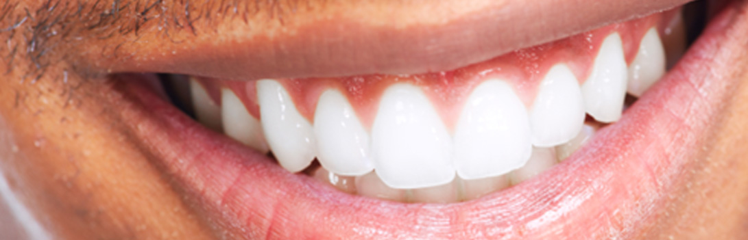 Closeup of a man smiling