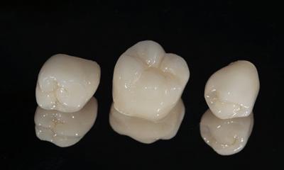 dental crowns in Wethersfield on black background