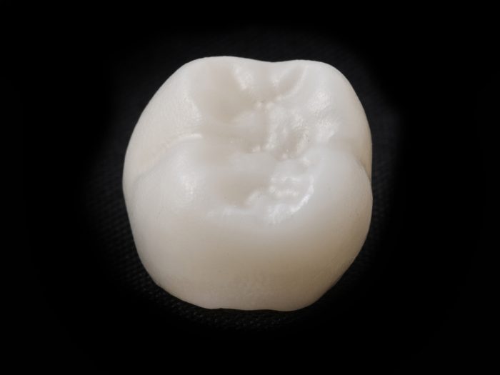 Close up of dental crown in Wethersfield against black background