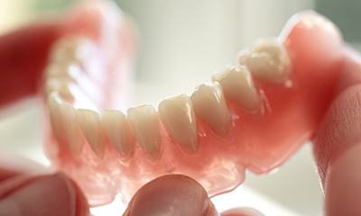 A series of dental restorations.