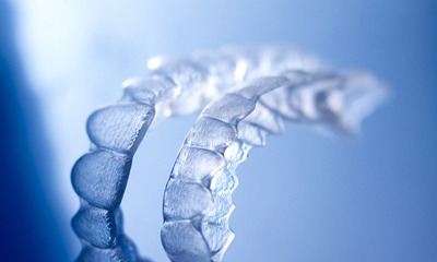 Upper and lower clear aligners.