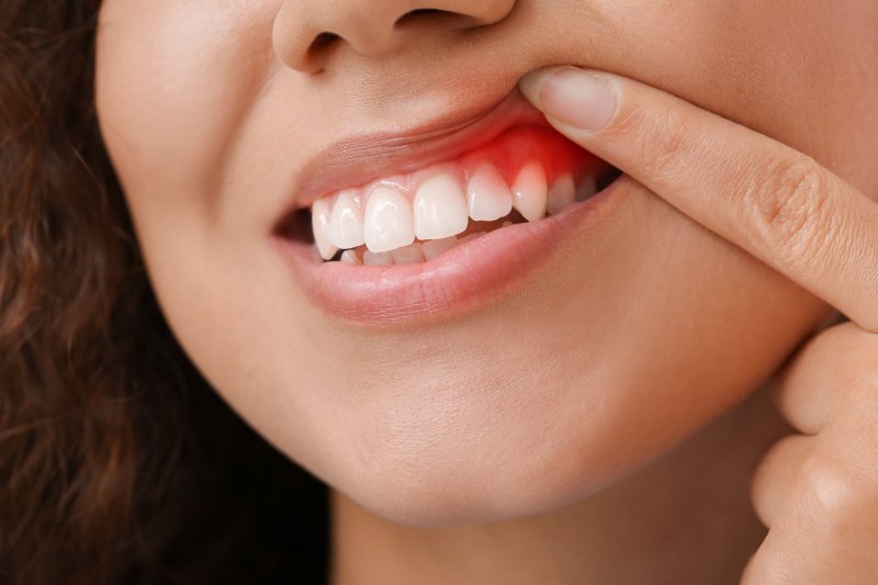 Could You Soon Test for Gingivitis at Home? | Dolan Dental